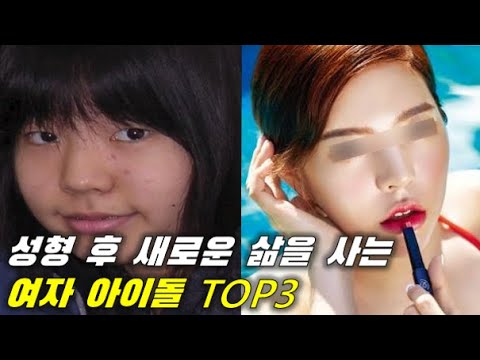 성형 후 새로운 인생을 살고 있는 여자아이돌 TOP3